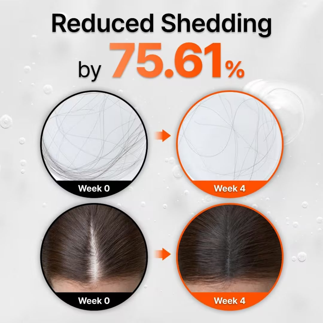 Daily Scalp Care for Stronger, Healthier-Looking Hair