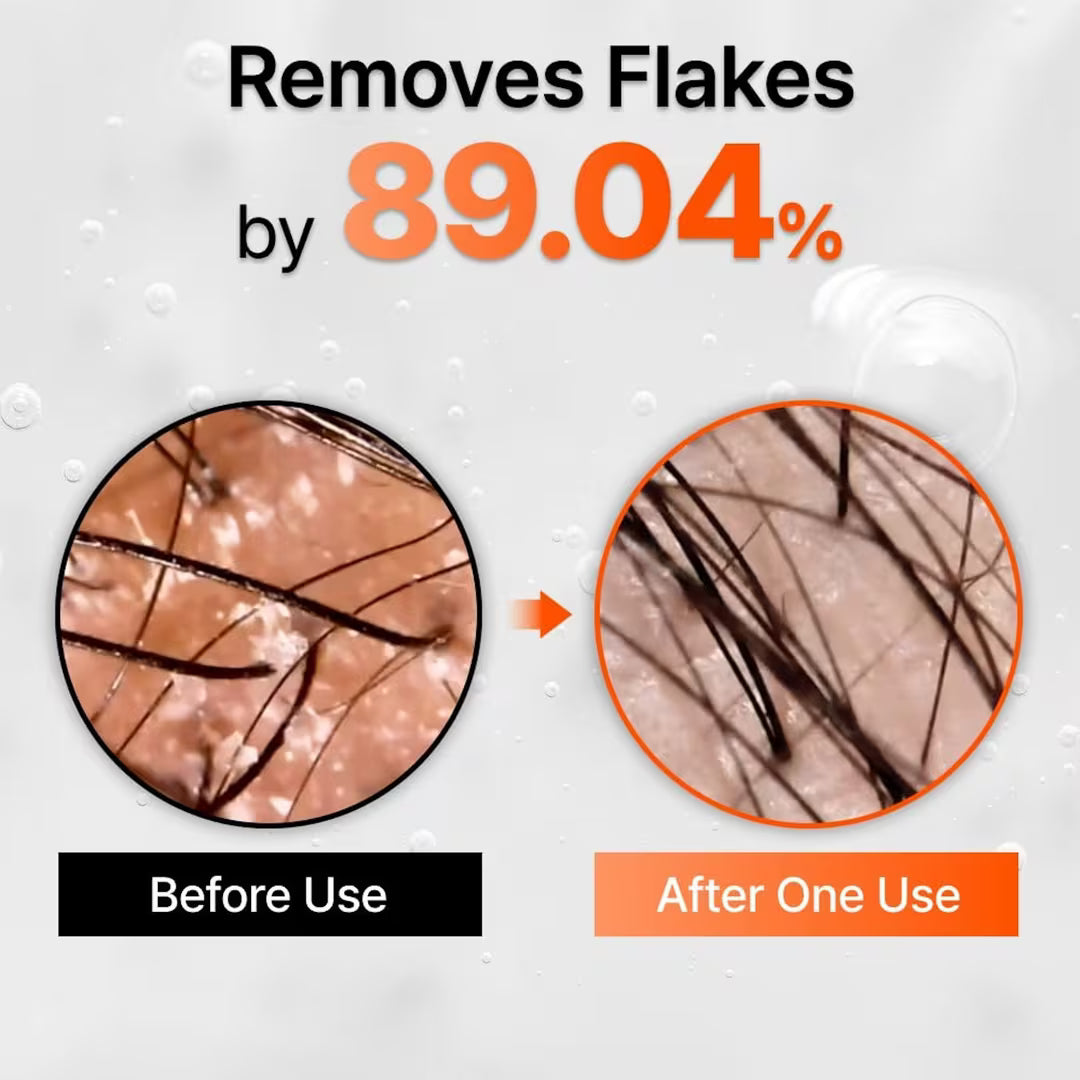 Daily Scalp Care for Stronger, Healthier-Looking Hair