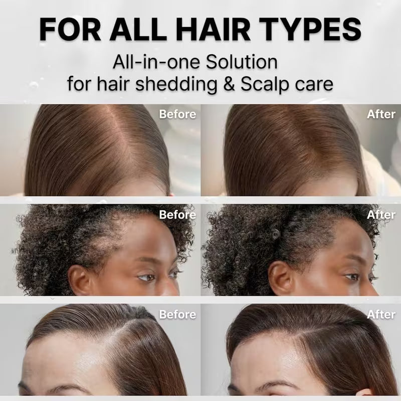 Daily Scalp Care for Stronger, Healthier-Looking Hair