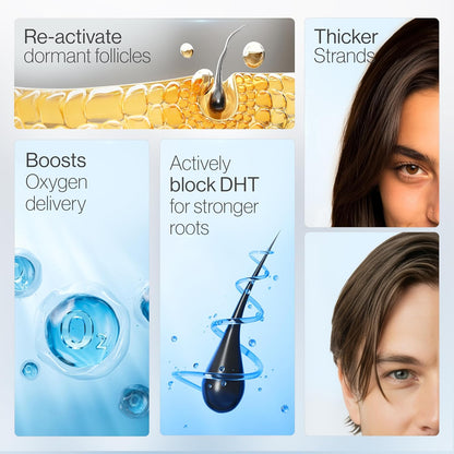 Advanced Hair Growth Roll-on Serum:Target the scalp,Support fuller‑looking hair.