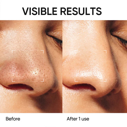 Alisanda Pore Reset Stick,Reset Your Pores in Minutes